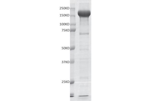 EHMT2 Protein (Lys9) (DYKDDDDK Tag)