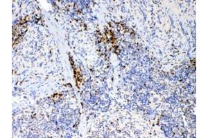 IHC testing of FFPE mouse spleen tissue with IL17A antibody at 1ug/ml. (Interleukin 17a antibody)
