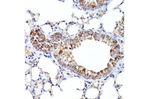 Immunohistochemistry of paraffin-embedded mouse lung using BNIP3L Rabbit pAb (ABIN6129989, ABIN6137622, ABIN6137623 and ABIN6221881) at dilution of 1:100 (40x lens).