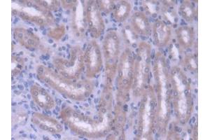 DAB staining on IHC-P; Samples: Rat Kidney Tissue (ABCG8 antibody  (AA 1-271))