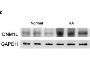 Enhanced mitochondrial fission in STs of RA patients correlates with disease severity. (GAPDH antibody)