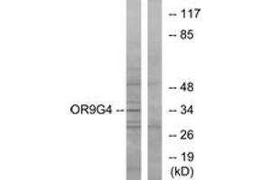 Western blot analysis of extracts from HeLa cells, using OR9G4 Antibody. (OR9G4 antibody  (AA 278-327))
