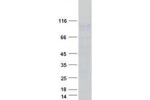 Western Blotting (WB) image for Sodium Potassium ATPase, alpha1 (ATP1A1) (Transcript Variant 1) protein (Myc-DYKDDDDK Tag) (ABIN2715039)