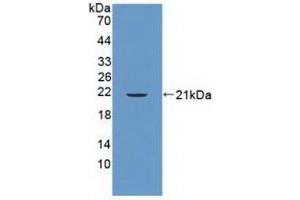 Detection of Recombinant PTPN13, Human using Polyclonal Antibody to Protein Tyrosine Phosphatase, Non Receptor Type 13 (PTPN13) (PTPN13 antibody  (AA 1-161))