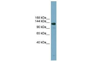ASXL2 antibody used at 1 ug/ml to detect target protein. (ASXL2 antibody)
