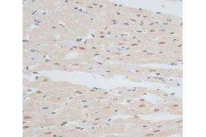 Immunohistochemistry (Paraffin-embedded Sections) (IHC (p)) image for anti-Zinc Finger Protein 148 (ZNF148) antibody (ABIN7262943)