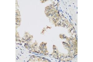Immunohistochemistry of paraffin-embedded human prostate using RRM1 antibody.