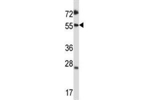 Western Blotting (WB) image for anti-SMAD, Mothers Against DPP Homolog 3 (SMAD3) (AA 127-156) antibody (ABIN3032620)