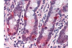 Image no. 1 for anti-Nucleotide-Binding Oligomerization Domain Containing 2 (NOD2) (C-Term) antibody (ABIN372922) (NOD2 antibody  (C-Term))