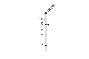 Western blot analysis of lysate from NCI- cell line, using Mouse Stk11 Antibody (C-term) (ABIN1537264 and ABIN2848945).