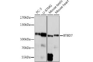 Western blot analysis of extracts of various cell lines, using BTBD7 Rabbit pAb (ABIN7265954) at 1:1000 dilution. (BTBD7 antibody)