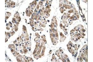 Image no. 1 for anti-Integrin beta 1 Binding Protein (Melusin) 2 (ITGB1BP2) (N-Term) antibody (ABIN204995) (ITGB1BP2 antibody  (N-Term))