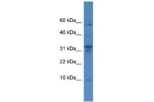 WB Suggested Anti-CTSC Antibody Titration: 0. (CTSC antibody  (Middle Region))