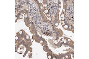 Immunohistochemical staining of human duodenum with B3GNTL1 polyclonal antibody  shows moderate cytoplasmic positivity in glandular cells.