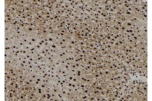 ABIN6267179 at 1/100 staining Mouse liver tissue by IHC-P.