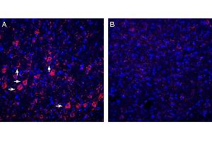 Expression of P2Y6 in rat cortex. (P2RY6 antibody  (Intracellular))