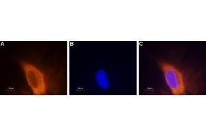 Expression of NaV1. (SCN3A antibody  (Intracellular))