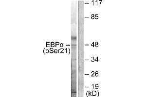 Western blot analysis of extracts from HepG2 cells treated with EGF (200ng/ml, 5mins), using C/EBP-α (phospho-Ser21) antibody. (CEBPA antibody  (pSer21))