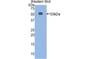 Detection of Recombinant aFP, Rat using Polyclonal Antibody to Alpha-Fetoprotein (AFP) (alpha Fetoprotein antibody  (AA 409-611))