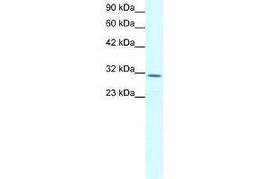 WB Suggested Anti-CLDN17 Antibody Titration:  2. (Claudin 17 antibody  (Middle Region))