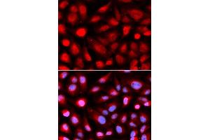 Immunofluorescence analysis of U2OS cell using RPL5 antibody. (RPL5 antibody  (AA 1-95))