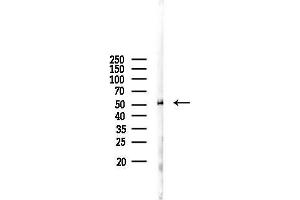anti-Cytochrome P450, Family 2, Subfamily C, Polypeptide 19 (CYP2C19) (C-Term) antibody