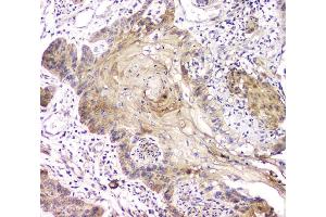IHC analysis of RAB11B using anti-RAB11B antibody (ABIN6719364). (RAB11B antibody)