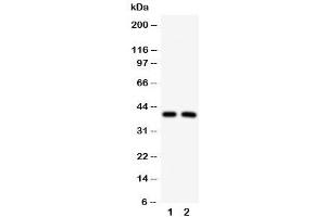 Western blot testing of IRF2 antibody and Lane 1:  HeLa