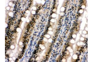 Immunohistochemistry (Paraffin-embedded Sections) (IHC (p)) image for anti-Mitogen-Activated Protein Kinase 13 (MAPK13) (AA 332-365), (C-Term) antibody (ABIN3043610) (MAPK13 antibody  (C-Term))