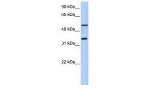 Image no. 1 for anti-Interaction Protein For Cytohesin Exchange Factors 1 (IPCEF1) (AA 254-303) antibody (ABIN6739458) (ICEF1 antibody  (AA 254-303))