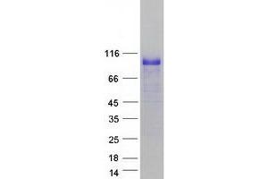 Validation with Western Blot (HIC1 Protein (Transcript Variant 1) (Myc-DYKDDDDK Tag))