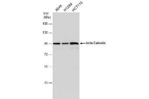 Western Blotting (WB) image for anti-Catenin (Cadherin-Associated Protein), beta 1, 88kDa (CTNNB1) (N-Term) antibody (ABIN2855042)