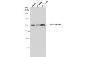 WB Image beta Catenin antibody [N1N2-2], N-term detects beta Catenin protein by western blot analysis. (CTNNB1 antibody  (N-Term))