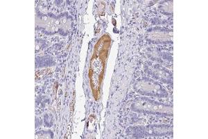 Immunohistochemical staining (Formalin-fixed paraffin-embedded sections) of human duodenum with APOB polyclonal antibody  shows distinct positivity in plasma at 1:500 - 1:1000 dilution. (APOB antibody)