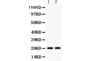 Anti-HSPB2 Picoband antibody, Western blottingAll lanes: Anti HSPB2  at 0.