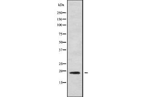 Western blot analysis IL1F9 using COLO205 whole cell lysates