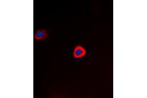 Immunofluorescent analysis of PAK1 (pT212) staining in Hela cells.