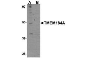 Western blot analysis in rat brain tissue lysate with TMEM184A Antibody  at 1 μg/ml in the absence (A) and the presence (B) of blocking peptide. (TMEM184A antibody  (C-Term))
