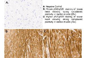 Immunohistochemistry (IHC) image for anti-Myosin, Light Chain 12A, Regulatory, Non-Sarcomeric (MYL12A) (N-Term) antibody (ABIN104491)