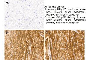 Immunohistochemistry with anti-myosin pS19/pS20 antibody showing strong cytoplasmic staining of myocytes in mouse heart muscle 20x and 40x (B & C).