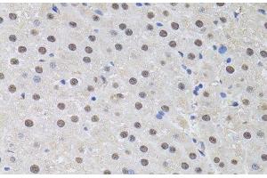 Immunohistochemistry of paraffin-embedded Rat liver using HUS1 Polyclonal Antibody at dilution of 1:100 (40x lens). (HUS1 antibody)