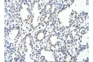 Immunohistochemistry (IHC) image for anti-Heterogeneous Nuclear Ribonucleoprotein A1 (HNRNPA1) (C-Term) antibody (ABIN2778790)