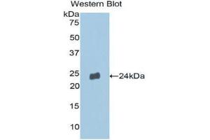 Western Blotting (WB) image for anti-Matrix Metallopeptidase 13 (Collagenase 3) (MMP13) (AA 290-468) antibody (ABIN1859847)