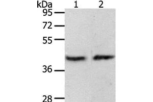 Western Blot analysis of MCF7 cell and Mouse brain tissue using PAX8 Polyclonal Antibody at dilution of 1:250 (PAX8 antibody)