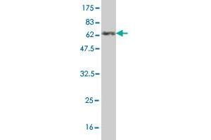 Western Blot detection against Immunogen (61. (Annexin A3 antibody  (AA 1-323))