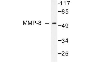 Image no. 1 for anti-Matrix Metallopeptidase 8 (Neutrophil Collagenase) (MMP8) antibody (ABIN265533) (MMP8 antibody)
