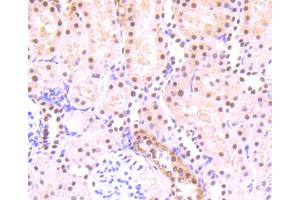 Paraformaldehyde-fixed, paraffin embedded rat Kidney, Antigen retrieval by boiling in sodium citrate buffer (pH6) for 15min, Block endogenous peroxidase by 3% hydrogen peroxide for 30 minutes, Blocking buffer at 37°C for 20min, Antibody incubation with STAT3(S727) (4G1) Monoclonal Antibody  at 1:50 overnight at 4°C, followed by a conjugated secondary and DAB staining. (STAT3 antibody  (pSer727))