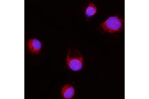 IF analysis of ERLIN2 using anti-ERLIN2 antibody (ABIN7602582). (ERLIN2 antibody  (AA 87-339))