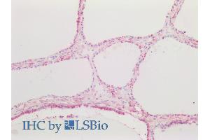ABIN6391343 (5µg/ml) staining of paraffin embedded Human Thyroid. (CTGF antibody  (AA 111-123))
