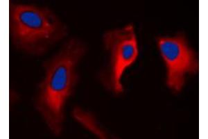 Immunofluorescent analysis of 14-3-3 zeta staining in MCF7 cells.